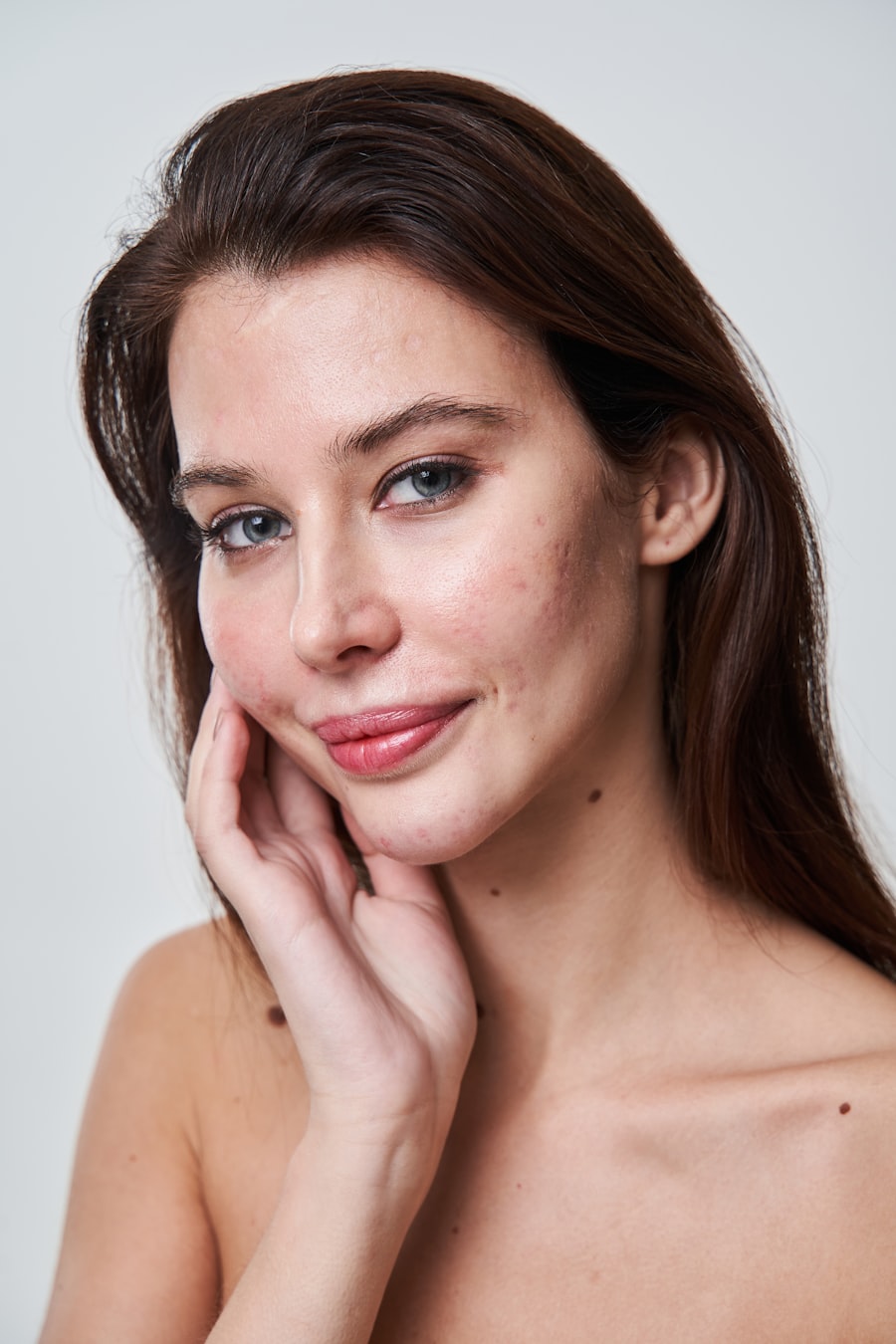 Collagen Microneedling + PDRN