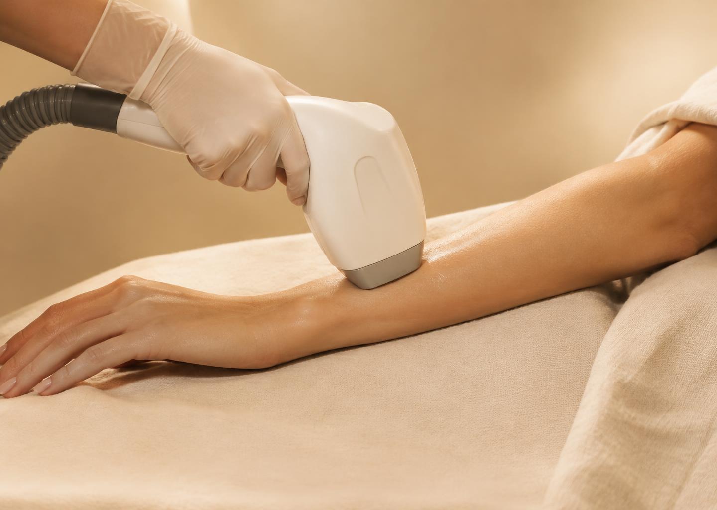 Medium Area Laser Hair Removal