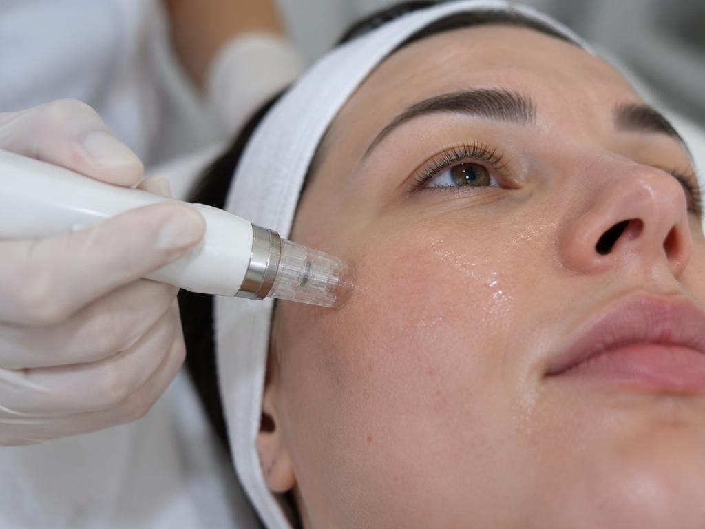 Collagen Microneedling + PRP